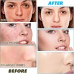 Kojic Acid, Vitamin C & Turmeric Face Cleansing Pads Combo | Brightening Skincare Kit for Dark Spots, Acne & Glowing Skin | 50 + 60 Pads - Image 6